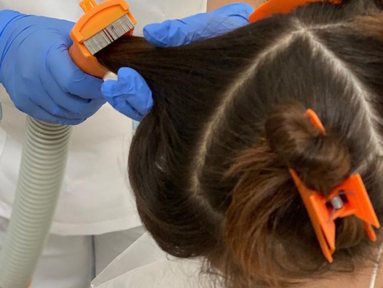 How Do Salons Remove Lice From Hair Permanently?
